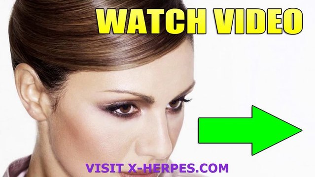 Genital Herpes Cure Receive Proven Alleviation Genital Herpes Cure