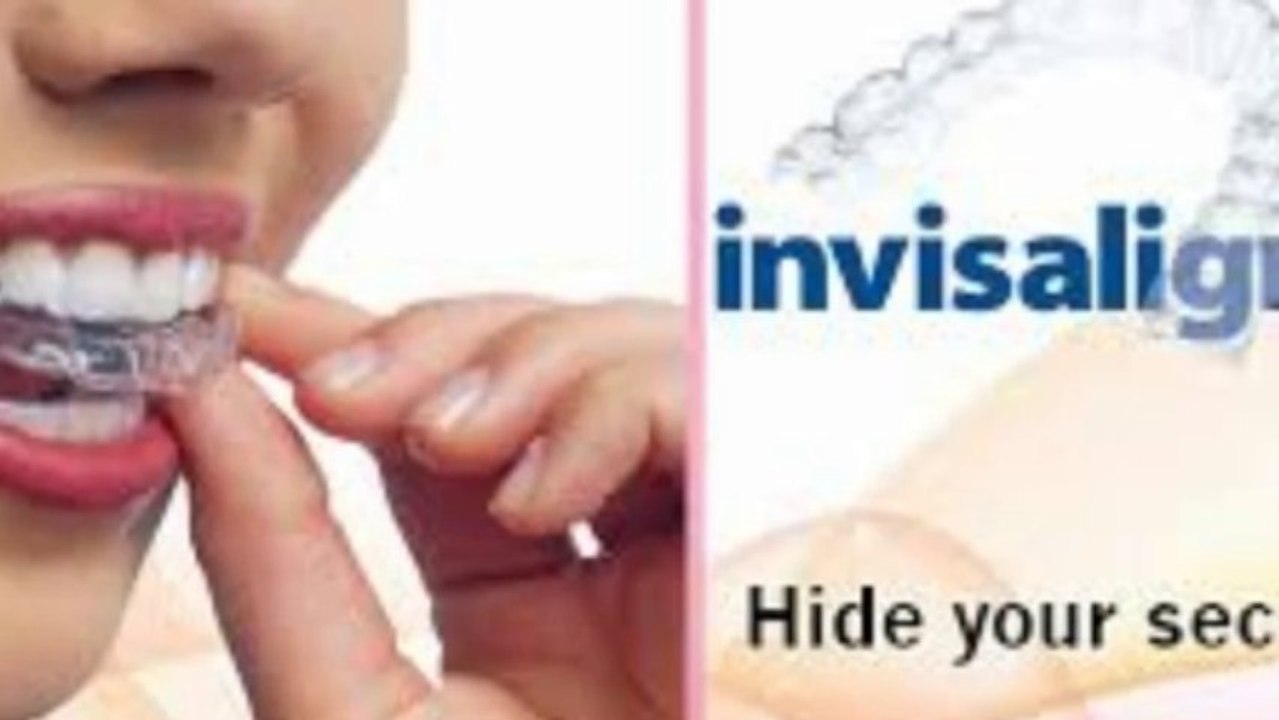 Dental Implants In London