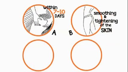 Natural way to get rid of cellulite in 28 days with truth about cellulite NK BEAUTY