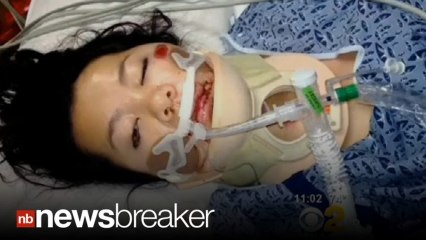 Handcuffed Woman Who Fell Out of Back of LAPD Squad Car Sues Police