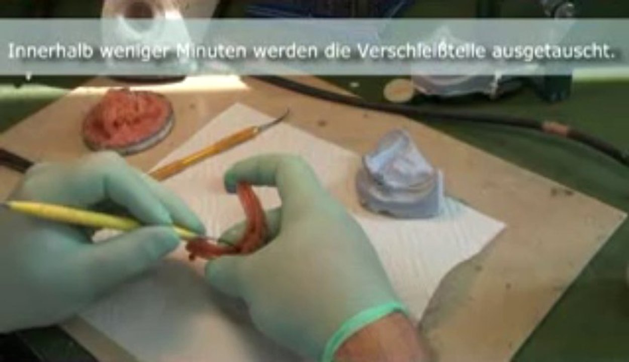 Zahnarztpraxis mit eigenem Zahntechniker - schnelle Abhilfe bei Prothetikproblemen