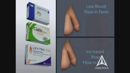 How to Treat Erectile Dysfunction? by Urologist in Tampa