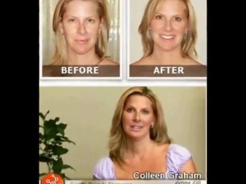 Anti Wrinkle Cream Lifecell Skin Cream Scam?