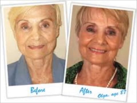 Buy LifeCell Antiaging Skin Cream