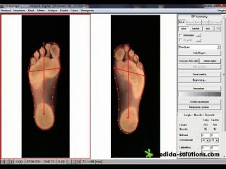 2D Voet Scanner & Custom Orthotics 🦶