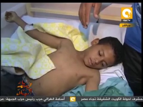 وسط البلد: لقاءات مع مصابي حادث محاولة إغتيال وزير الداخلية