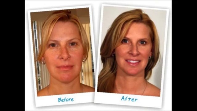 LifeCell Anti Wrinkle Cream - LifeCell Face Cream - LifeCell Skin - Life Cell Eye Cream