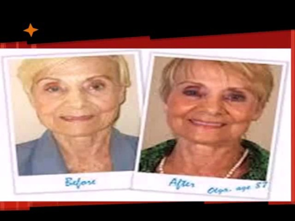 Lifecell Antiaging Skin Cream