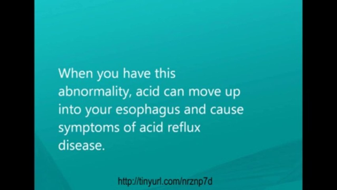Learn The Natural Way To Treat Acid Reflux Fast and Safe