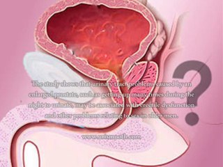 Swollen Prostate And ED