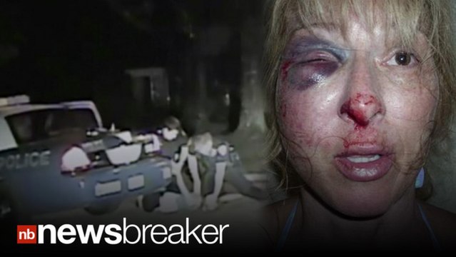 Woman’s Face Disfigured After Disturbing DUI Arrest in Florida