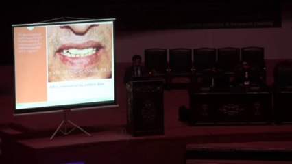 IADSR Conference 2013 Day 2 - 6. Dr Usman Anwar Bhatti