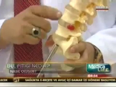 Bel Fıtığı Ameliyatı Nasıl YapılırBel Fıtığı Tedavi Yöntemleri Belirtileri Fiyatları