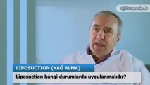 Liposuction hangi durumlarda uygulanmalıdır