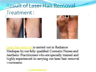 Laser Therapy Removes Hair Permanently