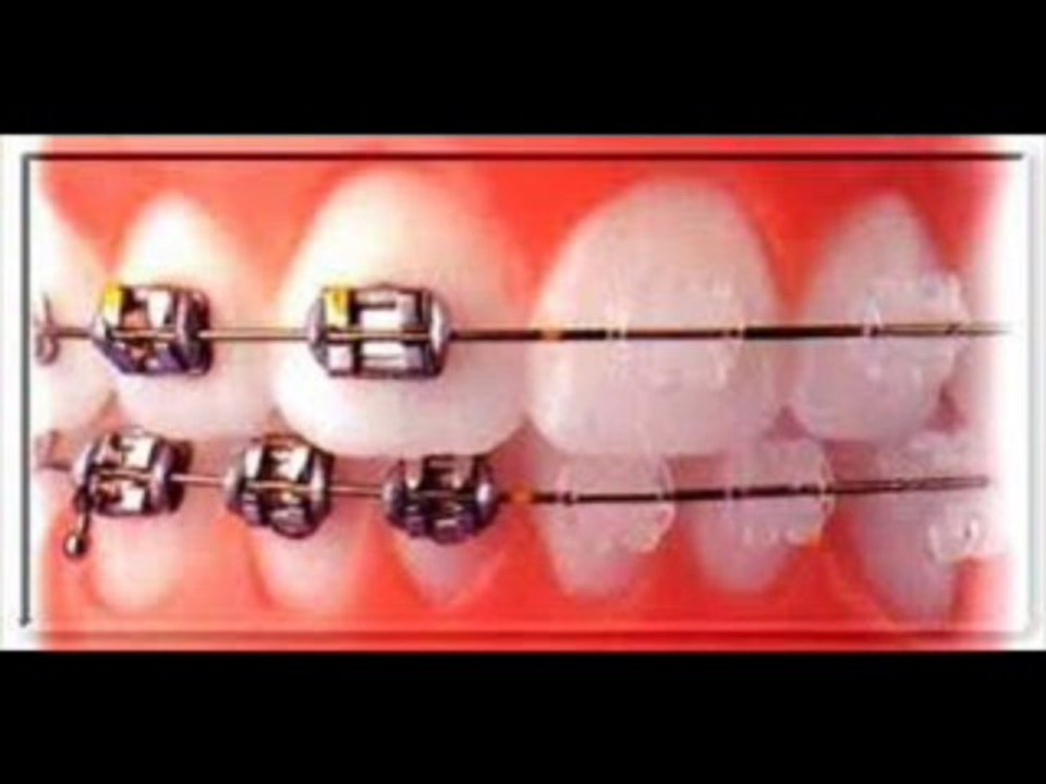 Dr.Robert Tupac DDS Dental brace