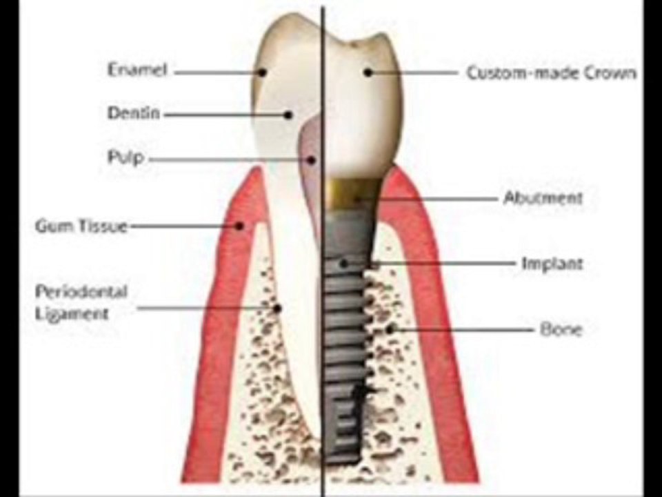 Dr.Robert Tupac DDS Dental implant