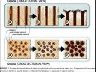 Dr.Robert Tupac DDS Dentin