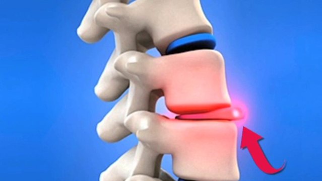 Vid camp 82 - Good Commercial