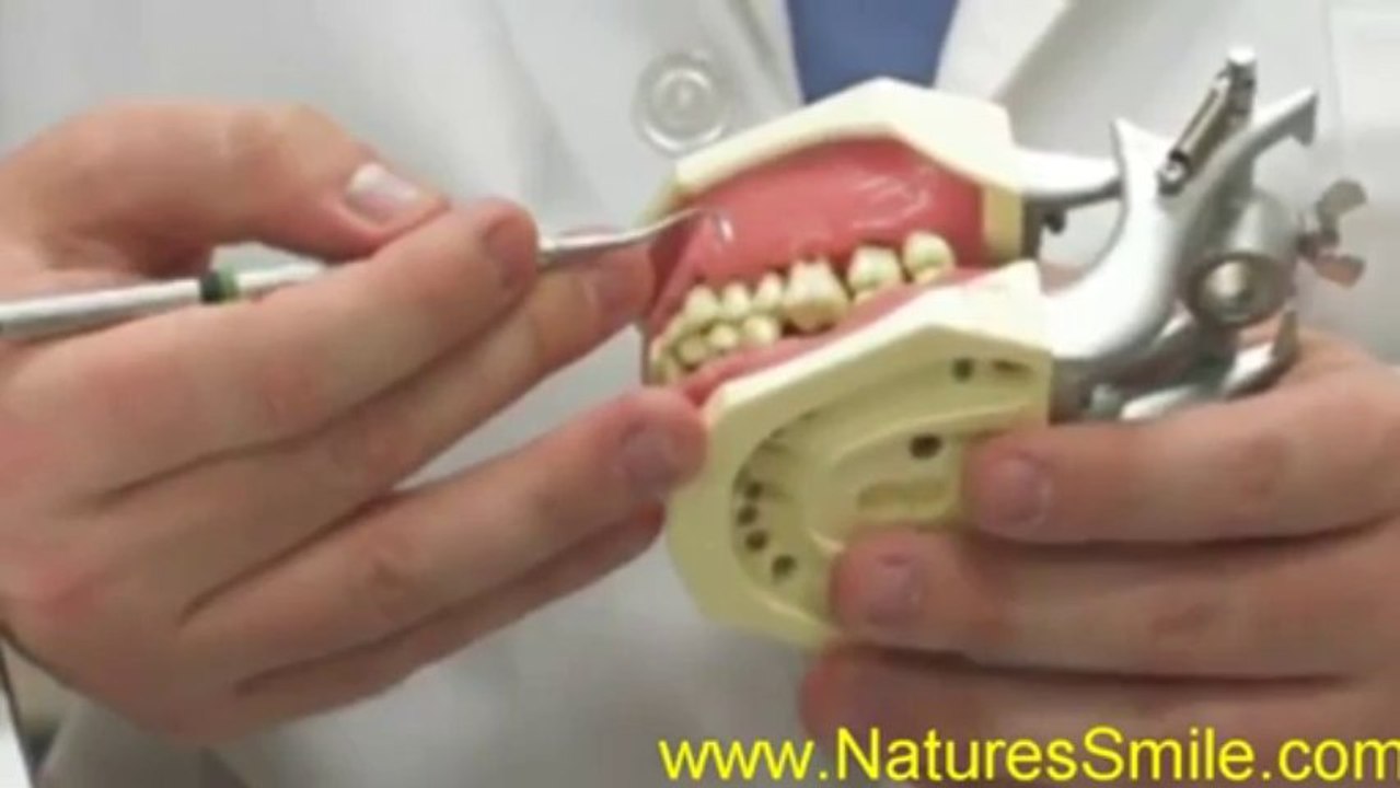 Robert Tupac DDS Gum_Disease