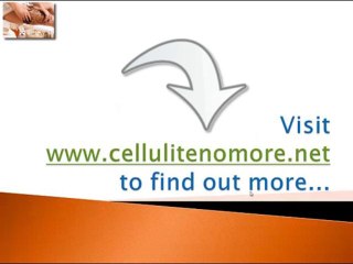 the best anti cellulite solution tip 7