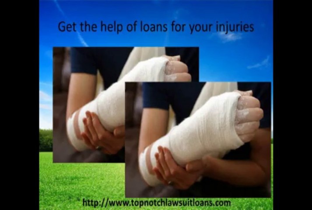 Supportive Commercial  lawsuit loans and lawsuit funding at TopNotch