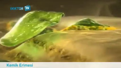 kemik erimesi nedir?