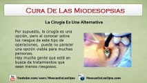 Miodesopsias Cura - Cual Es El Tratamiento Mas Efectivo Para Las Miodesopsias o Moscas En Los Ojos