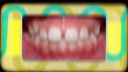 Greeley Orthodontist Aug2013