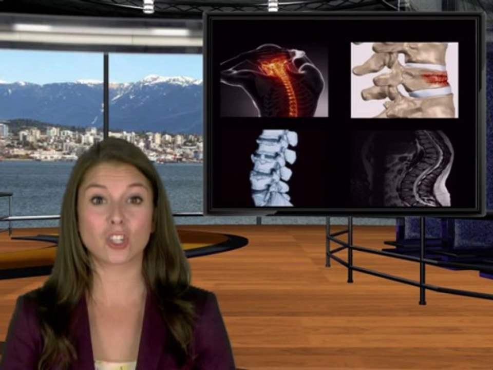 Aurora Spine Corporation (TSXV: ASG) New Listing