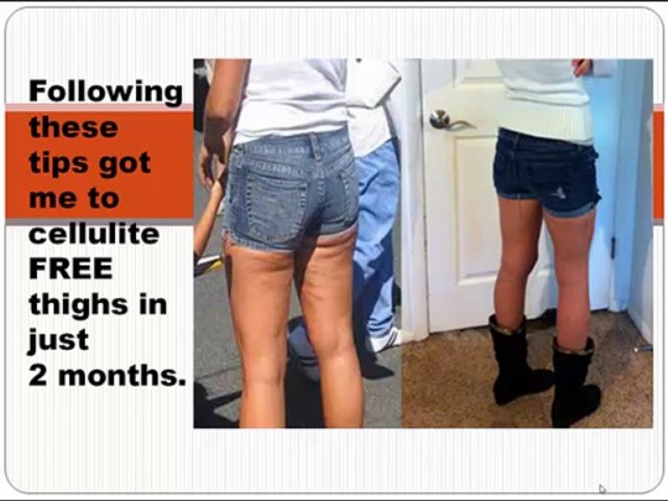 How to get rid of cellulite fast and naturally tip 1 .