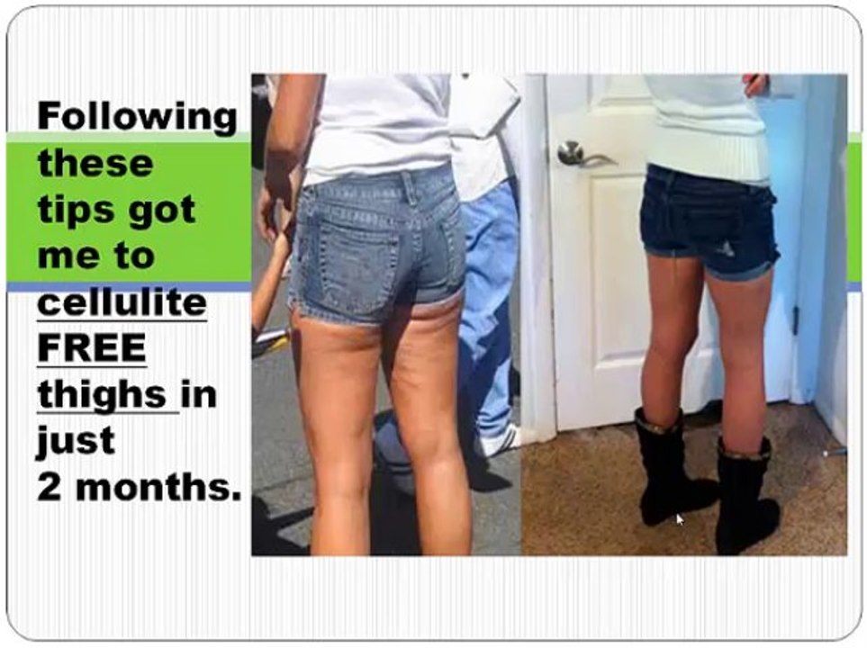 get rid of cellulite fast tip 12