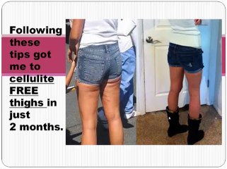 get rid of cellulite fast tip 15