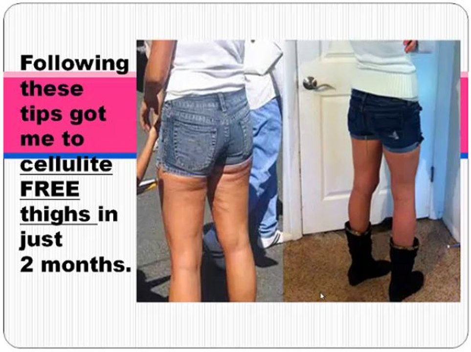 get rid of cellulite fast tip 20
