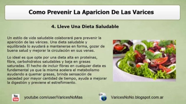 ¿Cómo Prevenir Las Varices?