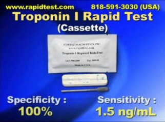 Troponin I Serum/Whole Blood Rapid Test (Cassette)