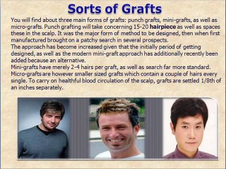 Hair Replacement and Restoration Strategies