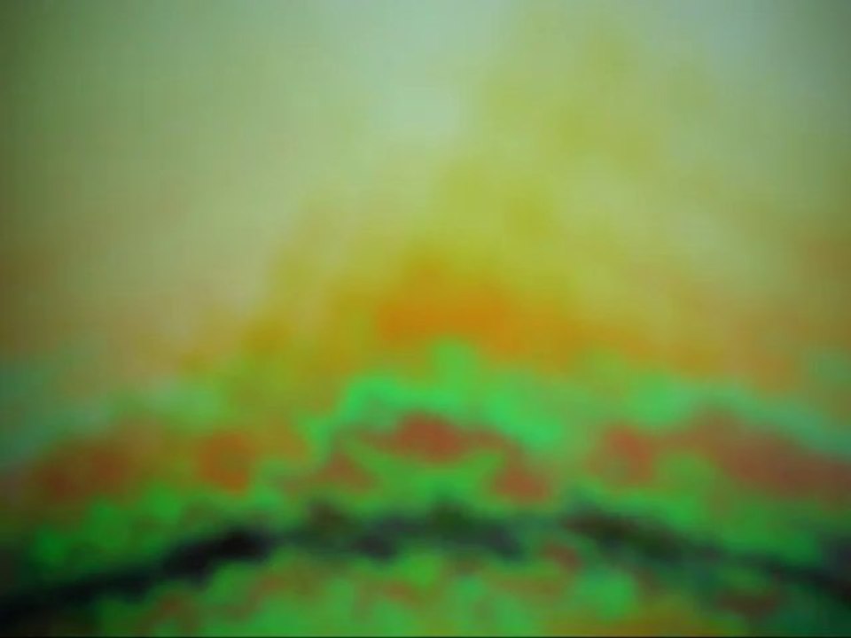 Raphael D. Hardy... Part 1 The Gigantic Pink Forest Full of Green Pine Cones