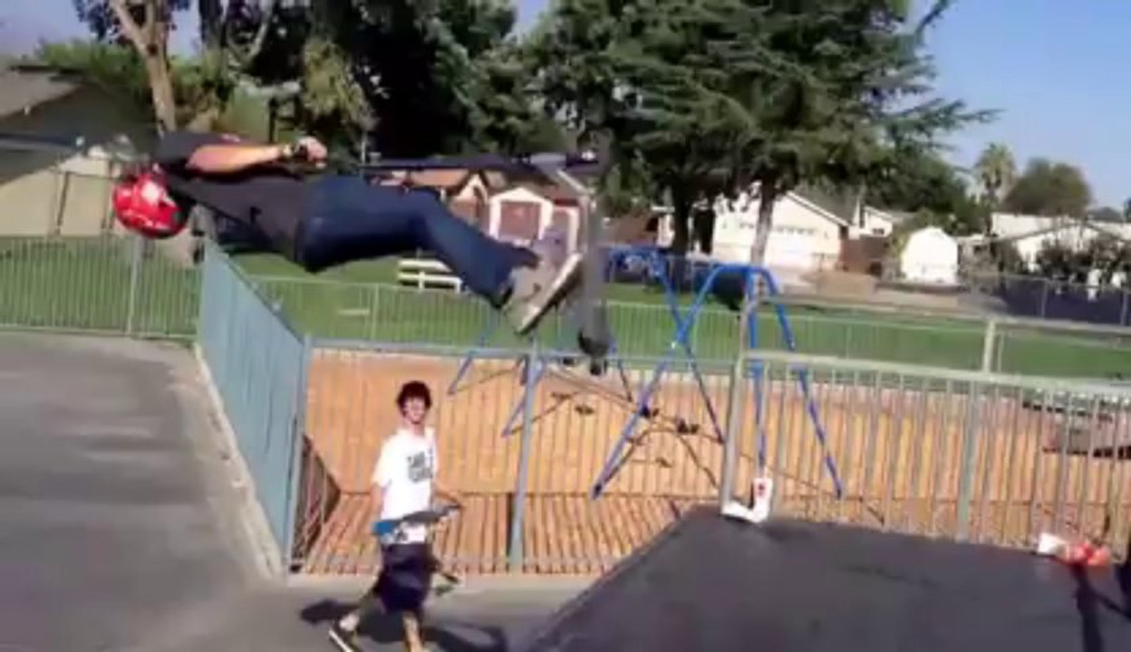 Backflip en trottinette : Gros FAIL!