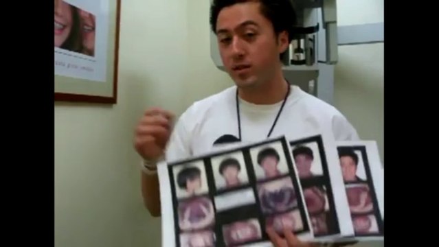 invisalign cost & orthodontists reviews