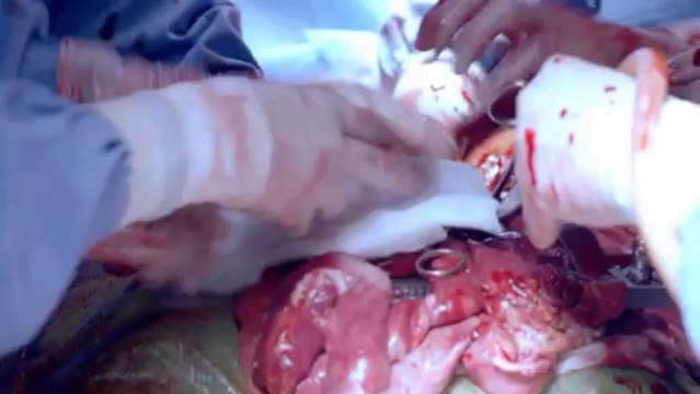 130925 SHINee MINHO - Medical TopTeam Highlight