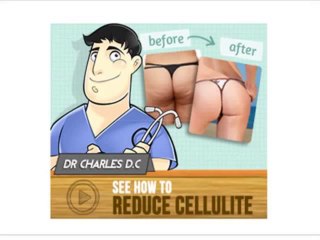 NEW: Cellulite Factor Review Cellulite Factor Treatment Reviews Does It Really Work?