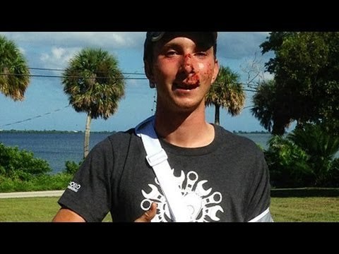 Deaf charity cyclist Jacob Landis injured in hit-and-run accident in Florida