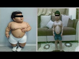 Before and After: Fat baby weight loss [PICTURES and VIDEO]