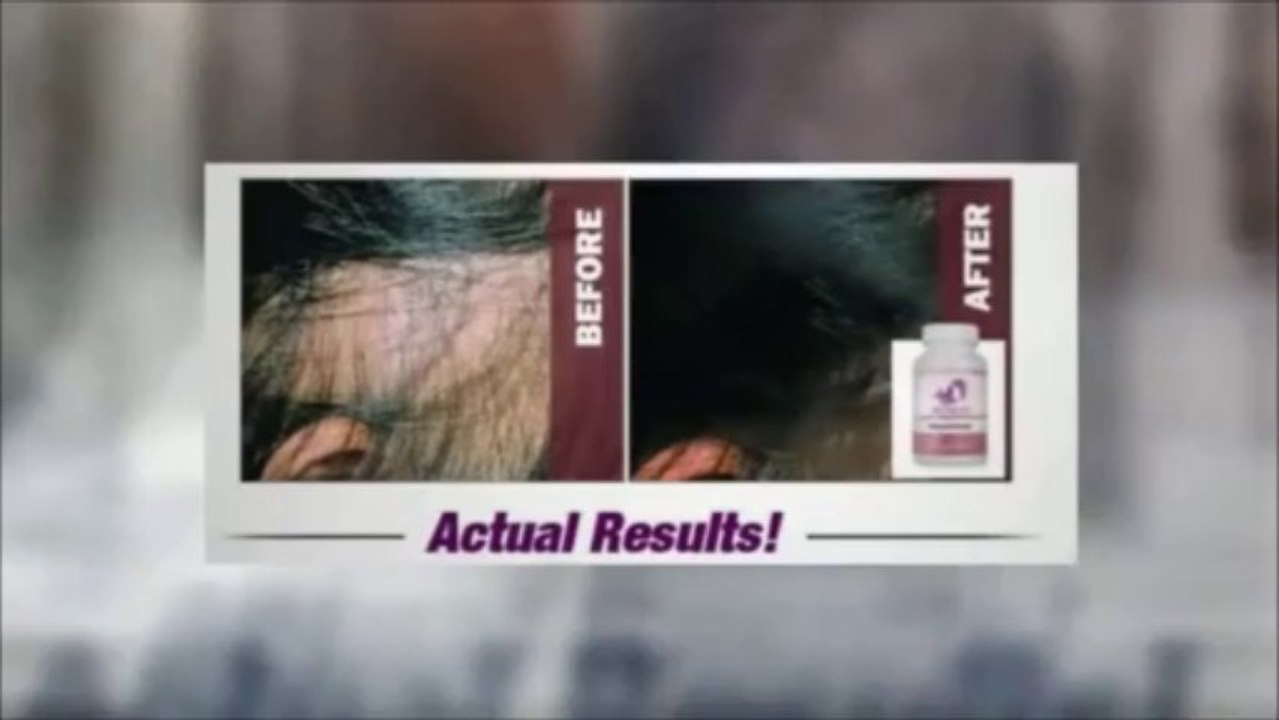 Provillus Review - Hair Loss Treatment