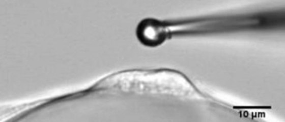 Microindentation of an endothelial cell
