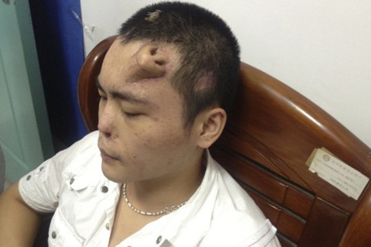 Chinois avec un nez sur le front