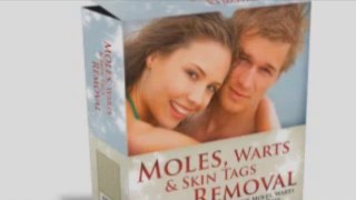 Moles, Warts & Skin Tags Removal Short Review