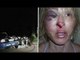 Police brutality: Tallahassee cops break Christina West's cheek in DUI stop