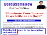Beat Eczema Now Review   How To Beat Eczema